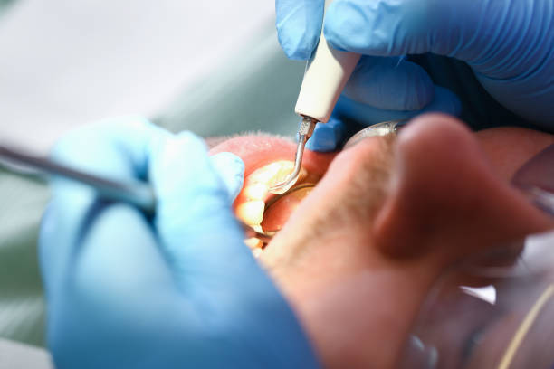 Best Urgent Tooth Repair  in Long Branch, NJ