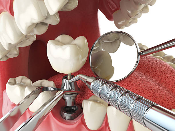 Best Emergency Tooth Extraction  in Long Branch, NJ